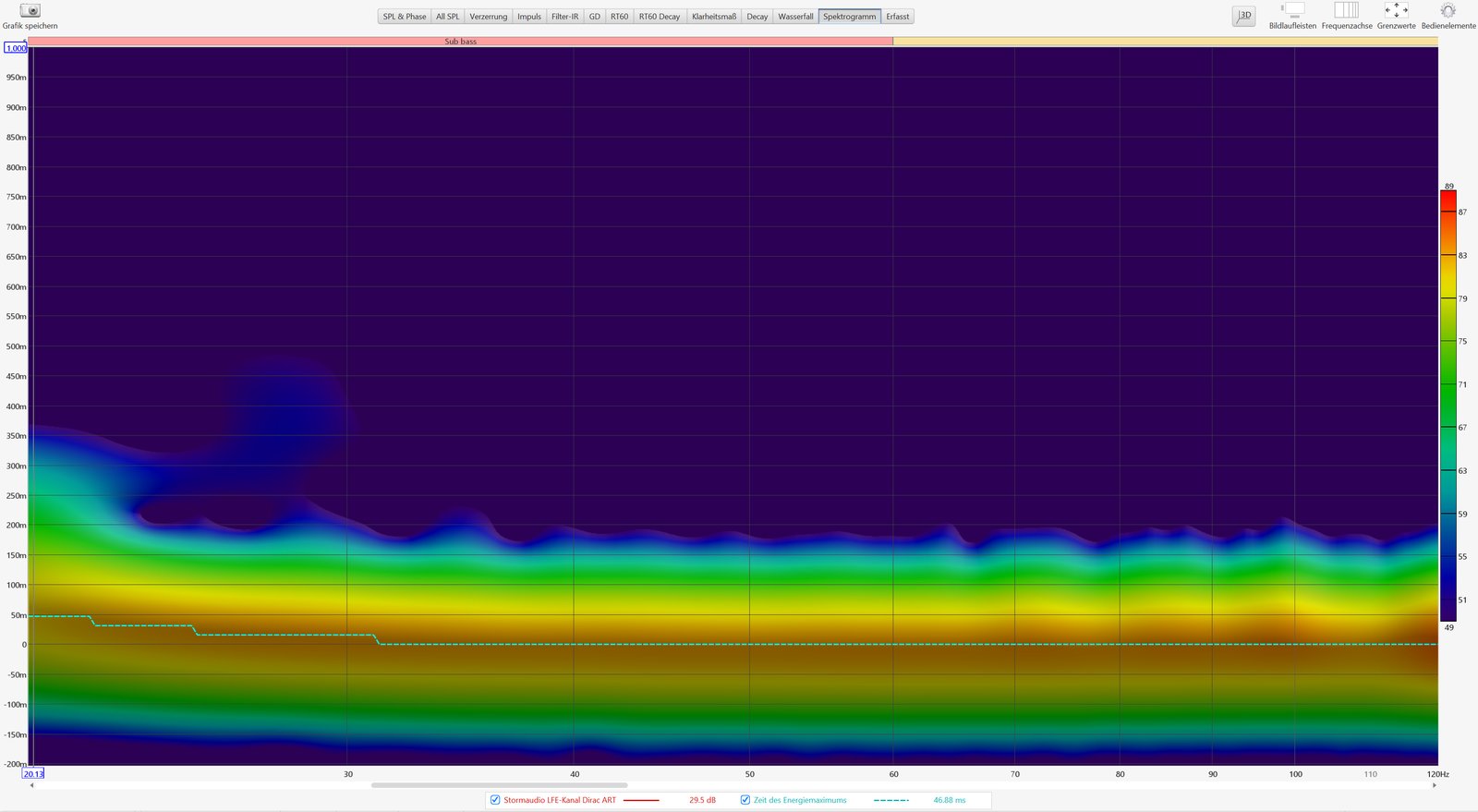 Grafik zeigt Darstellung der einzelnen Messpositionen in Audyssey MultEQ-X